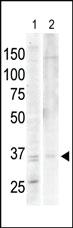 Anti-PKA C-alpha/PKA C-beta Rabbit Polyclonal Antibody