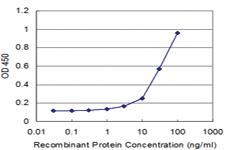 Anti-PLIN1 Mouse Monoclonal Antibody [clone: 4G1]