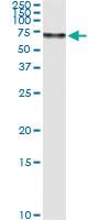 Anti-SERPINF2 Rabbit Polyclonal Antibody