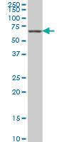 Anti-STK33 Mouse Monoclonal Antibody [clone: 1F10]