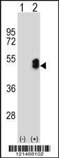 Anti-LIM/homeobox Protein 1.2 Rabbit Polyclonal Antibody (APC (Allophycocyanin))