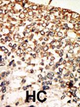 Anti-PKA C-alpha/PKA C-beta Rabbit Polyclonal Antibody