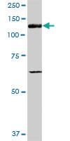 Anti-ITGA5 Mouse Polyclonal Antibody