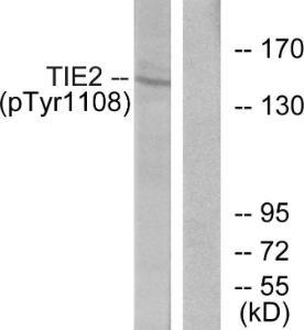 Western blot analysis of lysates from NIH/3T3 cells using Anti-TIE2 (phospho Tyr1108) Antibody. The right hand lane represents a negative control, where the Antibody is blocked by the immunising peptide