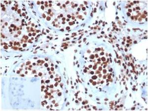 Immunohistochemical analysis of formalin-fixed, paraffin-embedded human testis tissue using Anti-SNF5 Antibody [SMARCB1/3984] at 2µg/ml. Inset: PBS instead of the primary antibody. Secondary antibody negative control.