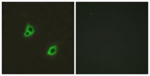 Immunofluorescence analysis of HUVEC cells using Anti-GPR126 Antibody. The right hand panel represents a negative control, where the antibody was pre-incubated with the immunising peptide.