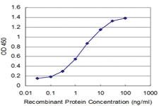 Anti-PIAS1 Mouse Monoclonal Antibody [clone: 4A4]