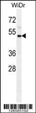 Anti-IL1R2 Rabbit Polyclonal Antibody (AP (Alkaline Phosphatase))