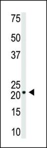 Anti-VSNL1 Rabbit Polyclonal Antibody