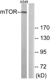 Western blot analysis of lysates from A549 cells using Anti-mTOR Antibody. The right hand lane represents a negative control, where the antibody is blocked by the immunising peptide.