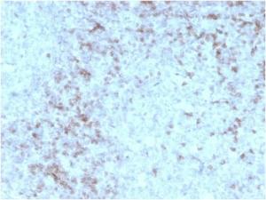 Immunohistochemical analysis of formalin-fixed, paraffin-embedded human spleen using Anti-CD3 epsilon Antibody [rC3e/1931]