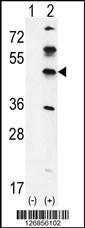 Anti-GKAP1 Rabbit Polyclonal Antibody (HRP (Horseradish Peroxidase))