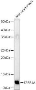 Western blot analysis of Mouse stomach, using Anti-SPRR1A Antibody (A308117) at 1:1,000 dilution