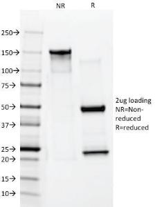 SDS-PAGE analysis of Anti-Cytokeratin 10 Antibody [AE20] under non-reduced and reduced conditions; showing intact IgG and intact heavy and light chains, respectively. SDS-PAGE analysis confirms the integrity and purity of the Antibody