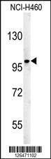 Anti-ST18 Rabbit Polyclonal Antibody