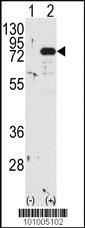 Anti-PKC beta1/2 Rabbit Polyclonal Antibody