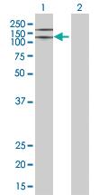 Anti-ITGA5 Mouse Polyclonal Antibody