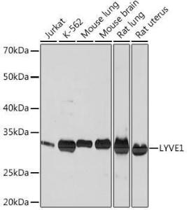 Western blot analysis of extracts of various cell lines, using Anti-LYVE1 Antibody [ARC0974] (A306991) at 1:1,000 dilution