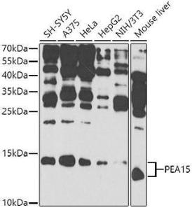 Western blot analysis of extracts of various cell lines, using Anti-PEA15 Antibody (A12429) at 1:1,000 dilution. The secondary antibody was Goat Anti-Rabbit IgG H&L Antibody (HRP) at 1:10,000 dilution.