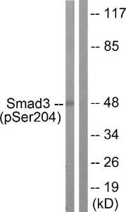 Western blot analysis of lysates from NIH/3T3 cells treated with Serum 20% 15' using Anti-Smad3 (phospho Ser204) Antibody. The right hand lane represents a negative control, where the antibody is blocked by the immunising peptide