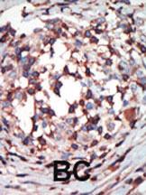 Anti-PKC beta1/2 Rabbit Polyclonal Antibody