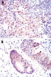 Anti-ASS1 Mouse Monoclonal Antibody [clone: 2C10]