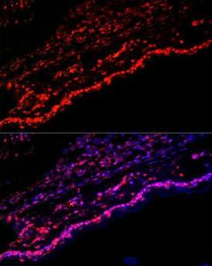 Immunofluorescence analysis of mouse skin cells using Anti-SPRR1A Antibody (A308117) at a dilution of 1:100 (40X lens). DAPI was used to stain the cell nuclei (blue)