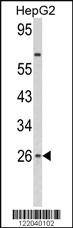 Anti-CRTRT1 Rabbit Polyclonal Antibody