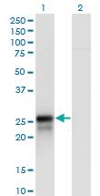 Anti-DIRAS2 Mouse Polyclonal Antibody