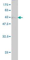 Anti-PIH1D1 Mouse Monoclonal Antibody [clone: M1]