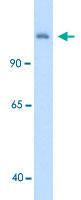 Anti-CPS1 Rabbit Polyclonal Antibody