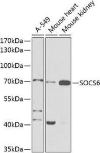 Western blot analysis of extracts of various cell lines, using Anti-SOCS6 Antibody (A12430) at 1:1,000 dilution. The secondary antibody was Goat Anti-Rabbit IgG H&L Antibody (HRP) at 1:10,000 dilution.