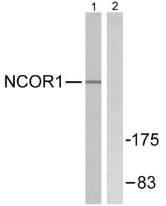 Western blot analysis of lysates from MDA-MB-435 cells using Anti-NCoR1 Antibody. The right hand lane represents a negative control, where the antibody is blocked by the immunising peptide