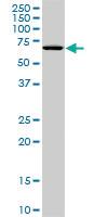 Anti-STK33 Mouse Monoclonal Antibody [clone: 1F10]