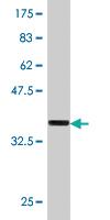 Anti-ZNF18 Mouse Monoclonal Antibody [clone: 2A4]