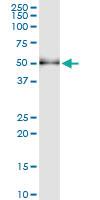 Anti-SH2D2A Polyclonal Antibody Pair