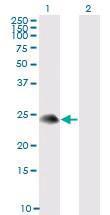 Anti-TSC22D3 Mouse Monoclonal Antibody [clone: 3A5]