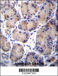 Anti-CES4A Rabbit Polyclonal Antibody