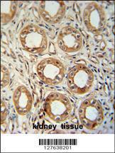 Anti-LNPEP Rabbit Polyclonal Antibody (FITC (Fluorescein Isothiocyanate))