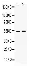 Anti-SERPINA1 Rabbit Polyclonal Antibody