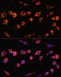 Immunofluorescence analysis of L929 cells using Anti-SCIN Antibody (A306993) at a dilution of 1:100. DAPI was used to stain the cell nuclei (blue)