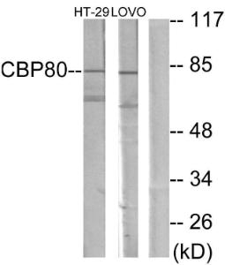 Western blot analysis of lysates from HT-29 and LOVO cells using Anti-NCBP1 Antibody. The right hand lane represents a negative control, where the antibody is blocked by the immunising peptide