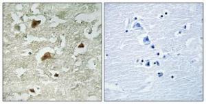 Immunohistochemical analysis of paraffin-embedded human brain using Anti-Smad3 (phospho Ser204) Antibody 1:100 (4°C overnight). The right hand panel represents a negative control, where the antibody was pre-incubated with the immunising peptide