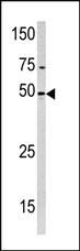 Anti-SIDT2 Rabbit Polyclonal Antibody