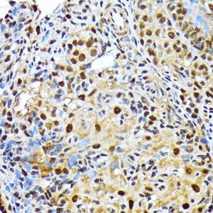 Immunohistochemistry analysis of paraffin-embedded rat ovary using Anti-ENT2 Antibody [ARC2234] (A306994) at a dilution of 1:100 (40x lens). Perform microwave antigen retrieval with 10 mM Tris/EDTA buffer pH 9.0 before commencing with IHC staining protocol.