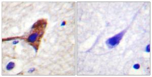 Immunohistochemical analysis of paraffin-embedded human brain tissue using Anti-mTOR Antibody. The right hand panel represents a negative control, where the antibody was pre-incubated with the immunising peptide.