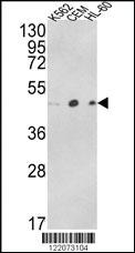 Anti-ACTR3B Rabbit Polyclonal Antibody