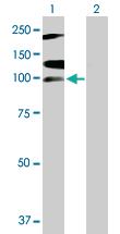 Anti-RNF111 Mouse Polyclonal Antibody