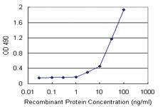 Anti-EEF1G Polyclonal Antibody Pair