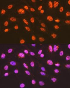 Immunofluorescence analysis of C6 cells using Anti-ENT2 Antibody [ARC2234] (A306994) at a dilution of 1:100 (40x lens). DAPI was used to stain the cell nuclei (blue).